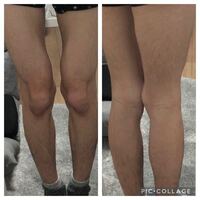 女性に質問です この脚どう思いますか ご意見ください 美脚にな Yahoo 知恵袋