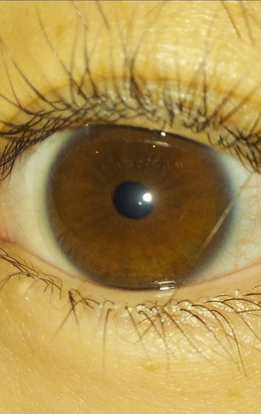 ⚠︎目の写真注意 瞳の柄？でパーソナルカラーを診断できるのがありますが、この写真だと何になりますか？ イエベ春 イエベ秋 ブルベ夏 ブルベ冬