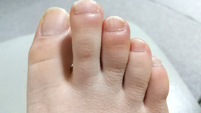 全体的に爪の周りが赤く腫れていて、特に中指が酷いんですが(左足もです)病院に行かないとまずいのでしょうか……？ 今受験生でなかなか外出しにくいのですが、行くほうが良いのなら今後の為に割り切って病...