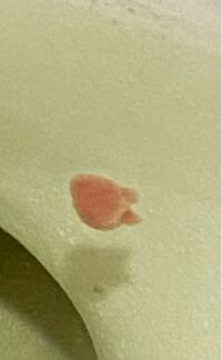 用を足したらピンクの塊が浮いていました パチンコ玉くらいの大きさ Yahoo 知恵袋