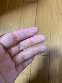 画像あり 閲覧注意 すごく水っぽいおりものがでます 量はドバドバ Yahoo 知恵袋