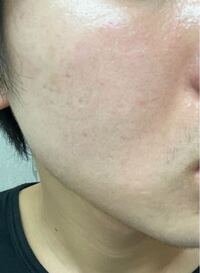 肌についてです 肌断食今してるんですけど大丈夫でしょうか 肌質は多分脂性肌より Yahoo 知恵袋