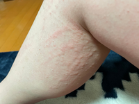 画像があります 苦手な方は見るのをやめてください お風呂に入って温ま Yahoo 知恵袋