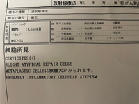 Mbti 診断1分