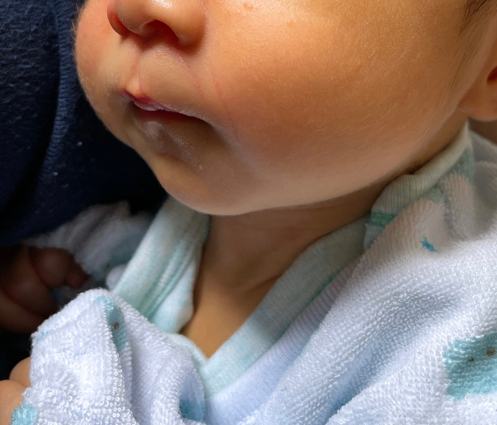 生後1ヶ月の赤ちゃんの顎について この写真を見て 小顎症でしょうか Yahoo 知恵袋