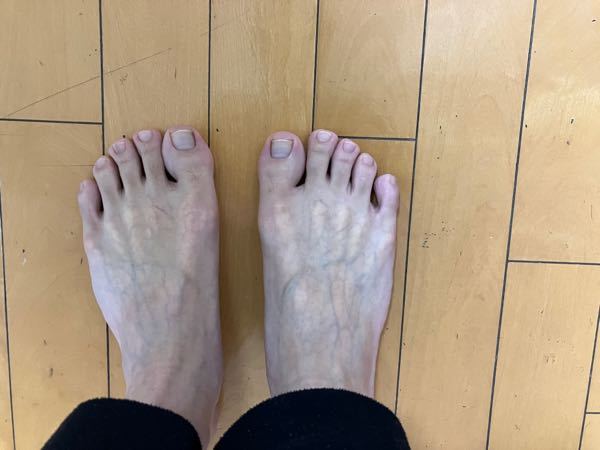 足の形について質問です エジプト型やギリシャ型など足の形にはパ Yahoo 知恵袋