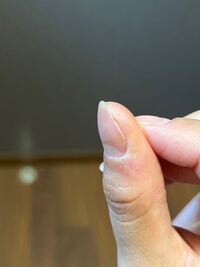 明日久々のジェルネイル予約してるんですが 爪と肉の間が乾燥からかぱっ Yahoo 知恵袋