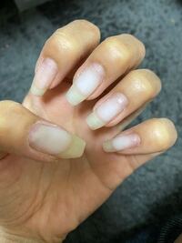 セルフネイルをしています フィルインしようと思ってベース層まで削りました Yahoo 知恵袋