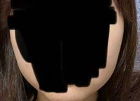 左右で頬の高さが違います。調べてみると顔が歪んでいるみたいなのですが何か改善する方法を教えてください 