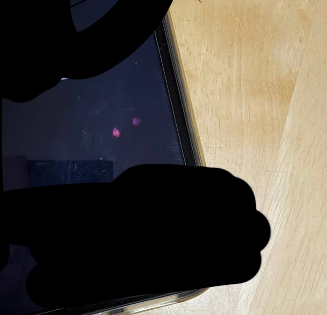 iPhoneでこんな斑点が現れました 電源を切ると消えますが、コレって広がったりしますか？