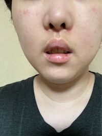 写真あり 私はお口ポカンがコンプレックスです 私の口元 おかしくないですか Yahoo 知恵袋