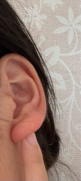 この耳たぶは厚い方ですか？ ピアス開ける時耳たぶ薄い人の方が痛くないと聞くので自分の耳はどうなのか気になりました。