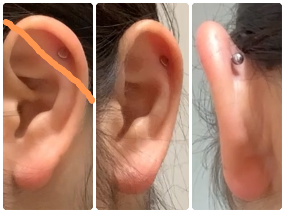 この耳はインダストリアルのピアスを付けられますでしょうか。軟骨の凹凸があって不安です。 またインダスを開ける際に、今付けてるヘリックスを外す必要はありますでしょうか。