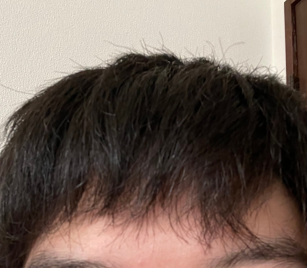 この髪質の改善方法ってありますか？
