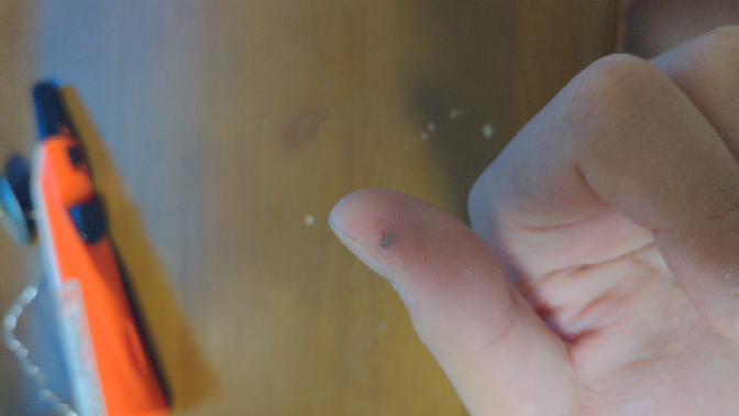 0.5ミリのドリルで下の画像ぐらい刺さってしまいました アルミの粉が付いていますが絆創膏で大丈夫でしょうか？