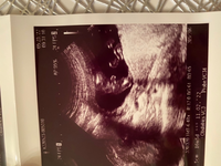 16w 5ヶ月 の妊婦です 2人目妊娠ですが このエコー写真をみて男の子か女の Yahoo 知恵袋
