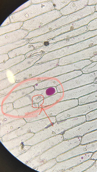 急いでいます 高校理科です 原形質分離についてです 原形質分離を確認する実 Yahoo 知恵袋