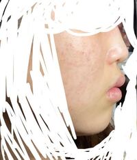 お見苦しい写真で申し訳ないのですが 私ってアデノイド顔貌ですか 自分 Yahoo 知恵袋