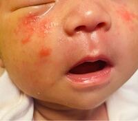 こんにちは 至急です 現在生後28日目の子供のことで質問です 気にな Yahoo 知恵袋