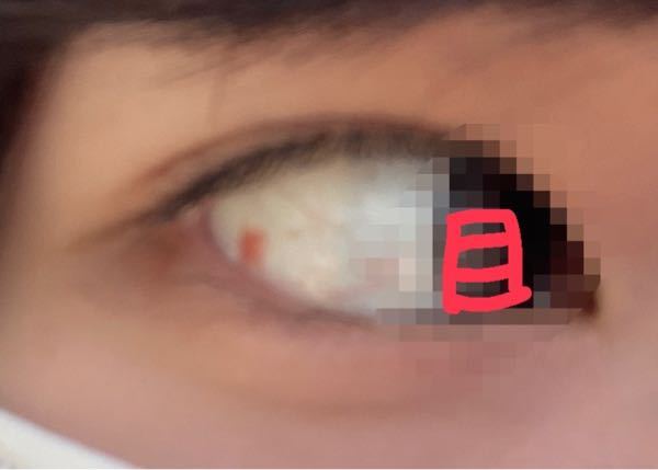 横を見た時に、白目の部分に赤い点がありました。 これはなんなのでしょうか？ 何かの病気ですか？ 眼科に行った方がいいのか教えてください