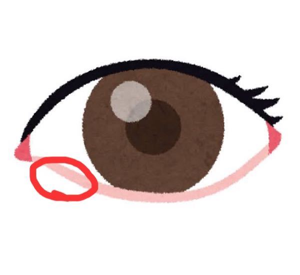 定期的に、目のここら辺が赤くなります。ぷくっと腫れはしませんが、押すと少し痛い程度です。こうなる原因はなんなのでしょうか？