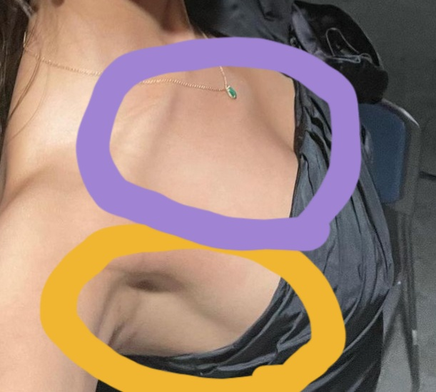 2つ質問があるのですが画像のように黄色の丸の部分の脇と胸をくっきりさせるのと 紫のデコルテ部分をふっくらさせるにはなんの筋トレが必要ですか？