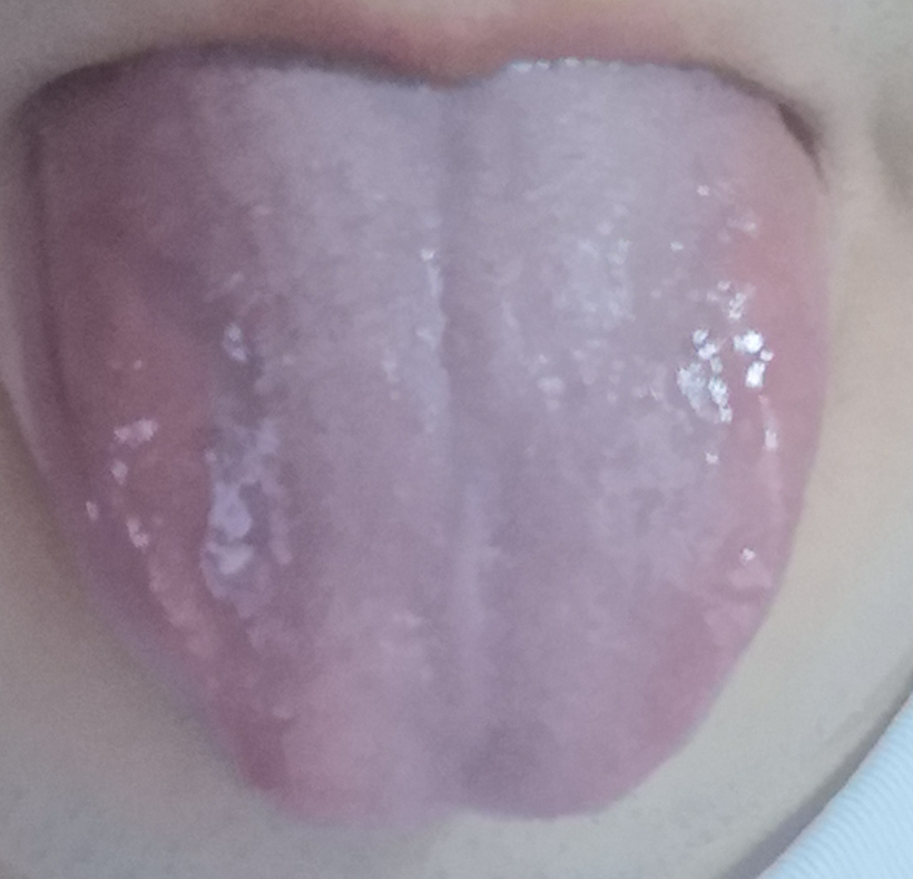 現在の舌はこんな感じなんですけどもう少し磨いた方がいいですか？ 口臭を消したいです。