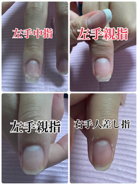 ネイルをして2週間で亀裂が入ってしまい同じサロンで補強してもらいまし Yahoo 知恵袋