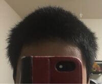 坊主伸びかけです この横はねはどうしたらいいですか Yahoo 知恵袋