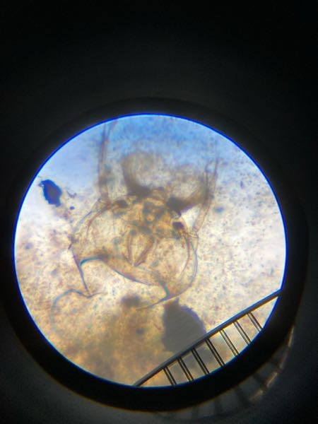 田んぼの水を顕微鏡で観察しましたが、このプランクトンが何か分かりません。教えて頂けると助かります。
