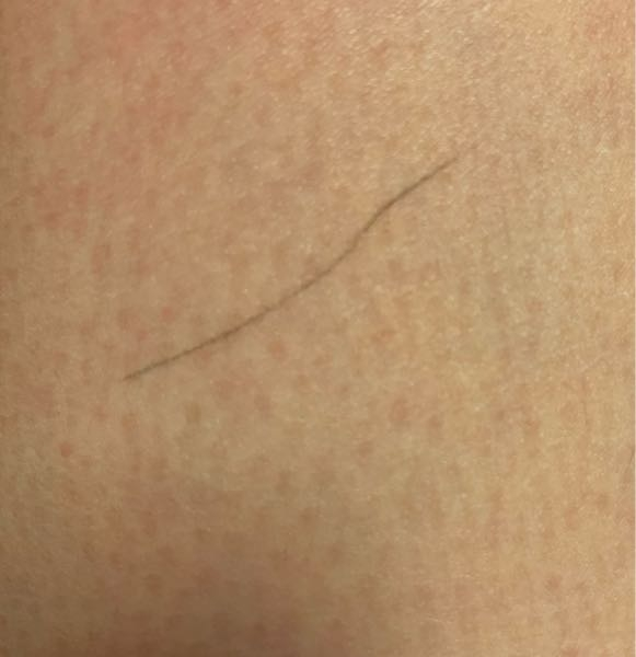 定期的に、私の足に出るこの黒い線は何でしょうか？ 膝にもです、出る時はいっぺんに左足のみに出ます。 潜り毛？と思うのですが、擦ると消えていきます。 ボールペンで書いたみたいです、、分かる方いらっ...