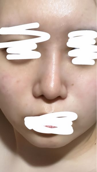 ダイソーノーズクリップ使ってる人に質問です 効果あったかそれのも逆 Yahoo 知恵袋