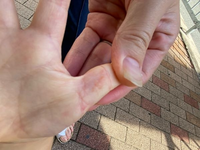 手足口病のブツブツができるのは、解熱後何日くらいからですか？

9月8日、39℃まで発熱して保育園早退後にすぐ病院に診察行きましたが、ただの風邪で終わり風邪薬を処方してもらいました。 たまに咳き込み、鼻水は吸引器使うほど出ます。
寝れないほどでは無いです。

熱は2日で解熱。
9日はトイレに流せないほどの軟便で下痢まではいかず。便の回数は多いものの、11日から徐々に回復し、12日の今朝はいつ...