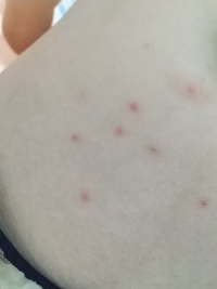 子どもの病気とトラブル 解決済みの質問 Yahoo 知恵袋