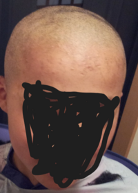 サッカー部の友達4人とリフティングの回数が一番少ない人が五厘にするという罰ゲー Yahoo 知恵袋