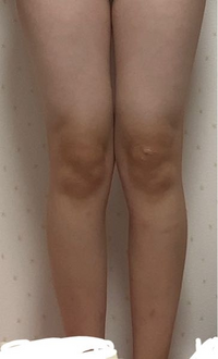 この画像の脚の 膝の皿は大きいほうですか またこの脚の場合 骨格はどれに当ては Yahoo 知恵袋