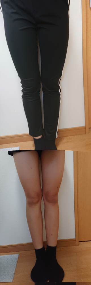 足太いですか また ショーパン スカートはいても大丈夫だと思いますか ま Yahoo 知恵袋