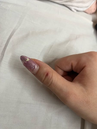 ネイルについて明日ネイルを変えにサロンに行くのですが画像の通り指第一関節を怪我 Yahoo 知恵袋