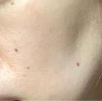 20代女です。

これってビニール肌ですか？ 私の肌の特徴はたぶんたるみ毛穴で、マスクでの肌荒れ痒み､マスク蒸れで赤みが出る、朝と日中が乾燥気味(ツッパるほどでは無い)ぐらいです。よろしくお願いします。