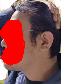 絶壁頭というか、斜頭症というか、小頭症というのか、そういう頭をしているとおもいますが、坊主～超短髪はやめておいたほうがいいですか。やはりジッと見てしまうほど異常でしょうか。 横から見たら、おでこ幅と毛が生えているエリアがほぼおなじ幅という後頭部の無さです。

写真は自分の横顔です。後頭部の髪の毛を抑えて撮影してます。