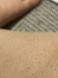 お目汚し失礼します 医療脱毛するため電気シェーバーを使っているのですがこのような短い毛が剃れません。ここまで剃れる電気シェーバーありますか？使っているのはPanasonic ES-WR61-pボディフェリエです。
また脱毛前にカミソリを使ってはいけないのでしょうか