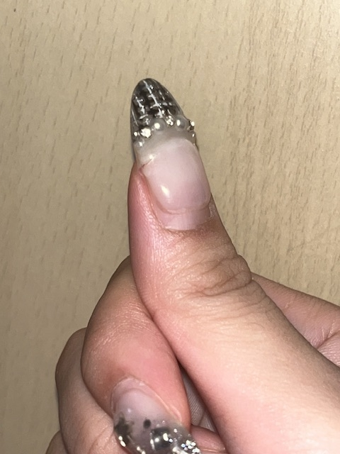 大至急！！！！！自爪の親指が、ジェルネイルごと折れかけてます、泣