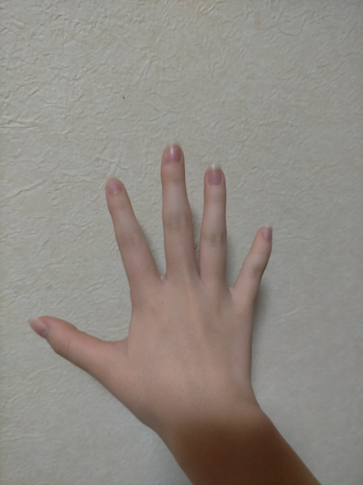 手ブレ酷くて申し訳ないのですが、この中指のペンだこ治す方法ってないですか？学生なので、ペンを持たないってことは出来なくて、小学生の頃からずっと治らなくて結構コンプレックスなんですよね… あと爪のピンクのところを長くする方法も知ってる方いたら教えて欲しいです…