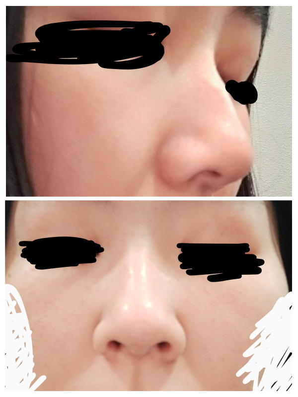 私の鼻なんですけど、鼻の形の種類は何でしょうか…？ 高いですか低いですか…？