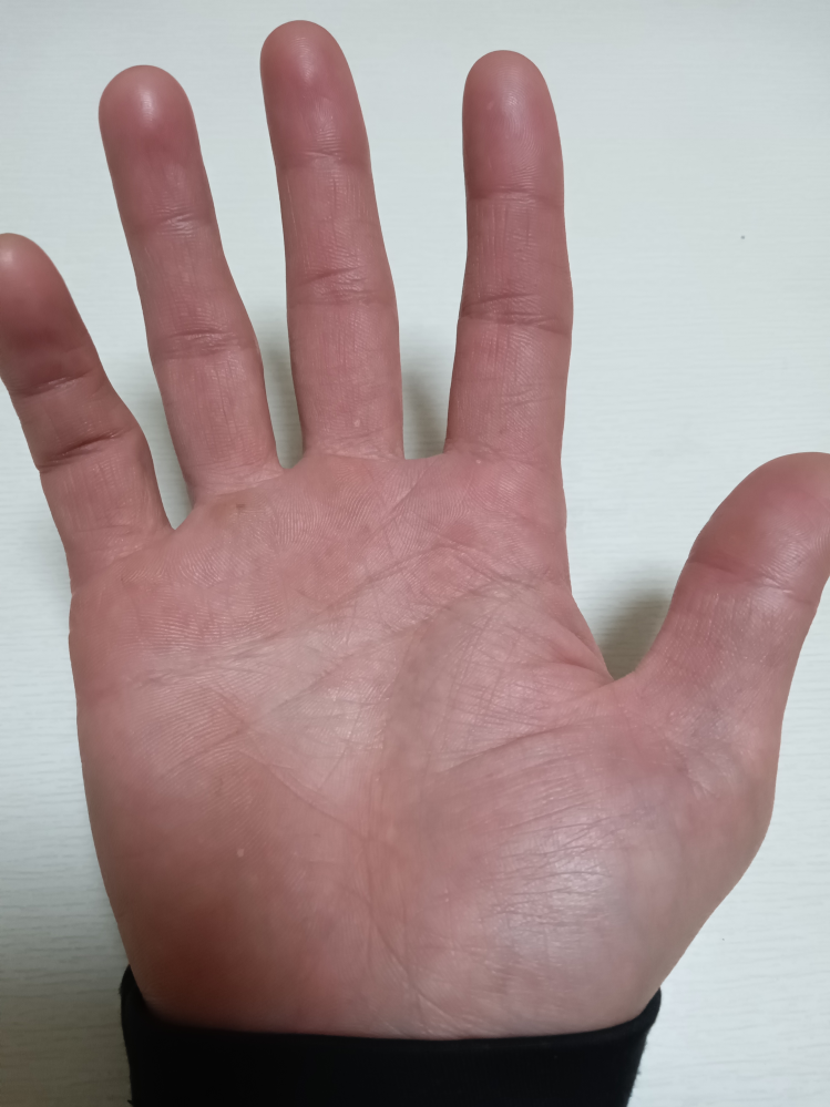 手相についてです…。 昔から、病弱でしたり今年、本厄 だったりと、不安要素だらけで…。 手相の診断できる方御願い致します。
