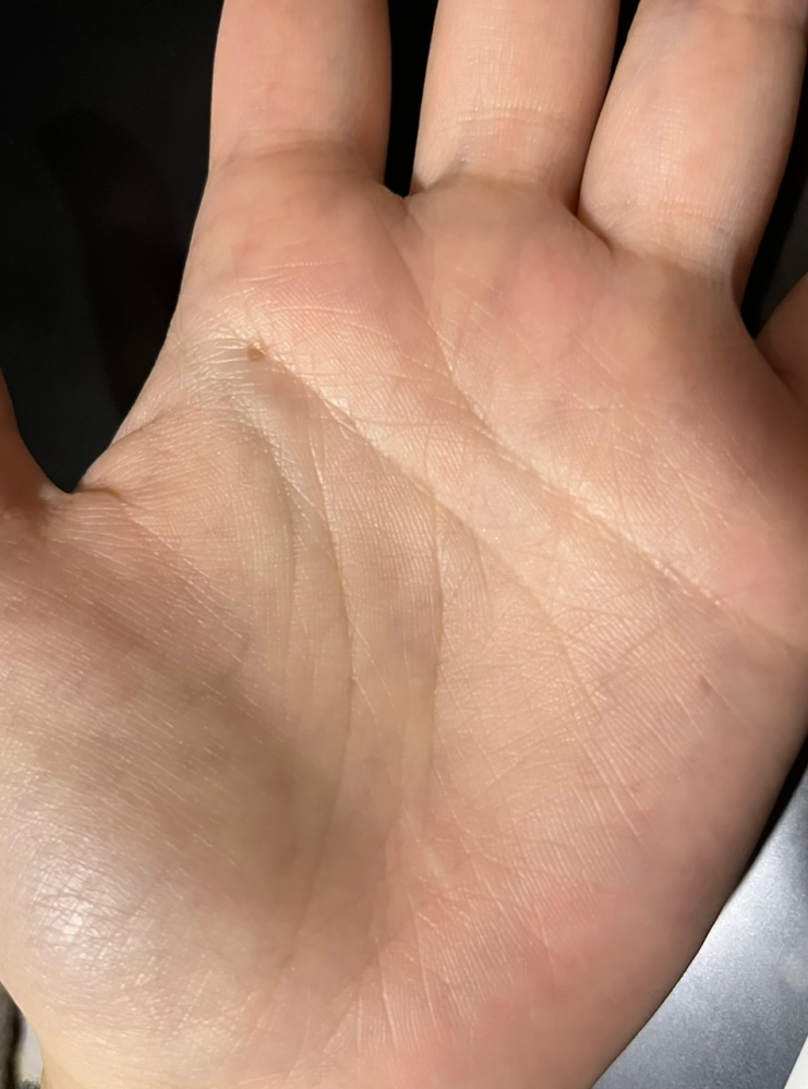 生命線が短いです 横にもう一本あってそっちは長いのですが すごくうっすらつながっているようで切れているような感じで縁起悪そうで悲しいです いい感じのアドバイスや手相読みで励ましていただけませんか？