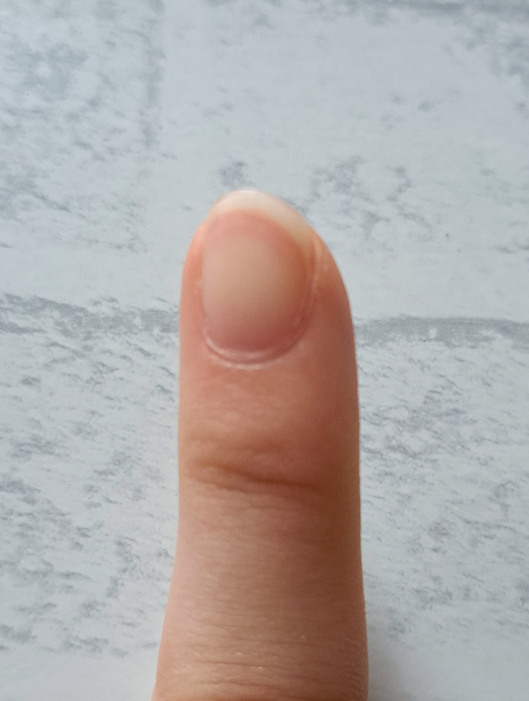 爪を綺麗にする方法が知りたいです！ 画像のように爪の白い部分がどんどん下に行っています。また、ピンクと白の境目の部分がガタガタしていて清潔感あるように見えません。これは爪の切り方が悪いのでしょうか？ 治し方を教えてくださいm(_ _)m