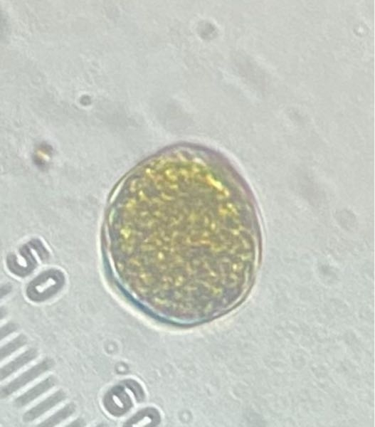 至急です！この微生物が何か知っていますか？150μmぐらいです。