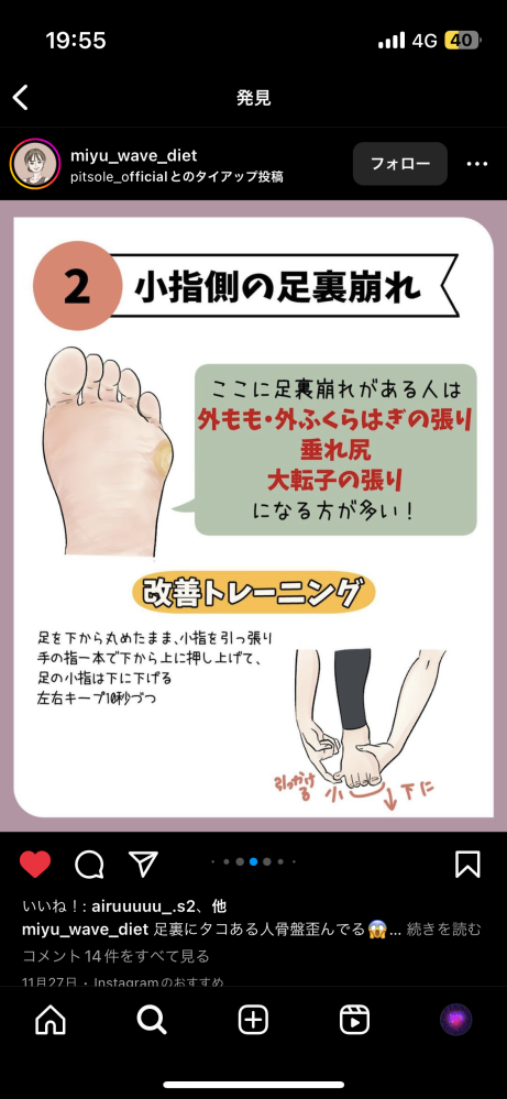 足のストレッチで骨盤の歪みを治す！みたいな投稿があり、やってみようと思ったのですが ストレッチ説明の文章を理解できません。 誰か教えてください。 ＿＿＿＿＿＿＿＿＿＿＿＿＿＿＿＿＿＿＿＿ 足を下から丸めたまま、小指を引っ張り手の指一本で下から上に押し上げて、足の小指は下に下げる 左右キープ10秒づつ ↑どういうことですか？