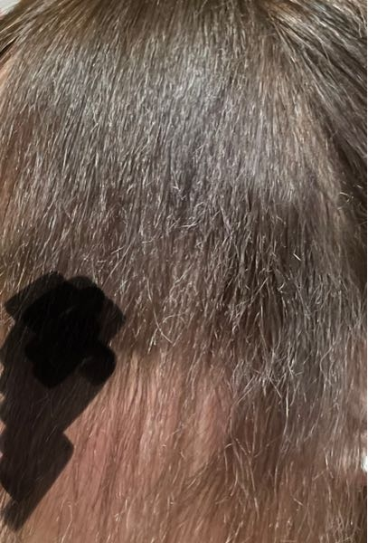 枝毛が本当にやばくて、(特に前髪、サイド、てっぺん)どうやって元に戻りますか。 本当に汚くて、ドライヤーした後の写真です。 出来れば、お店とかではなく自分でヘアケアできる方法を教えてくれませんか？ どうしたらいいか？効果があったヘアオイル、トリートメントなどがあったら、是非お願いします。 本当に人生やり直したい…毎日楽しくない 人に会ったり、すれ違うのが恥ずかしい… まじで自分が気持ち悪い